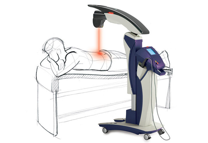 MLS Laser Therapy at Whole Foot Care