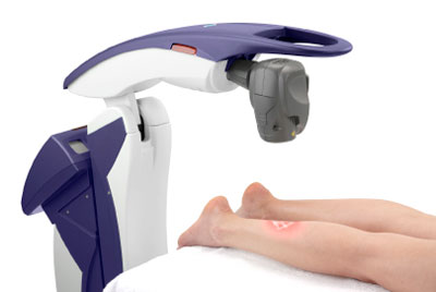 MLS laser therapy being delivered to a foot and ankle